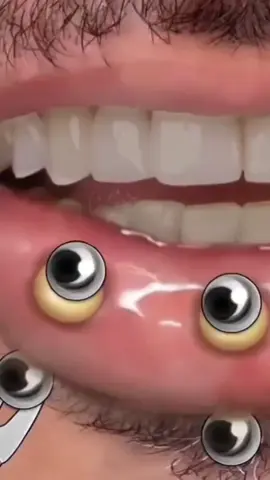 ASMR  #acne #pointsnoirs #blackheads #ASMR 