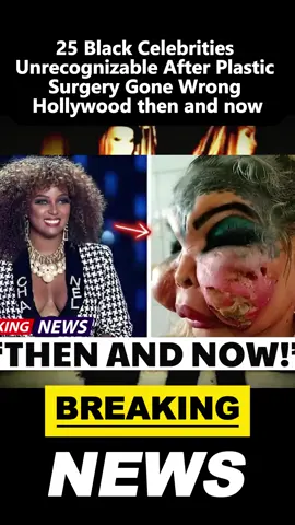 25 Black Celebrities Unrecognizable After Plastic Surgery Gone Wrong Hollywood then and now. #breakingnews #viral #trending #hottrend #foryoupage 