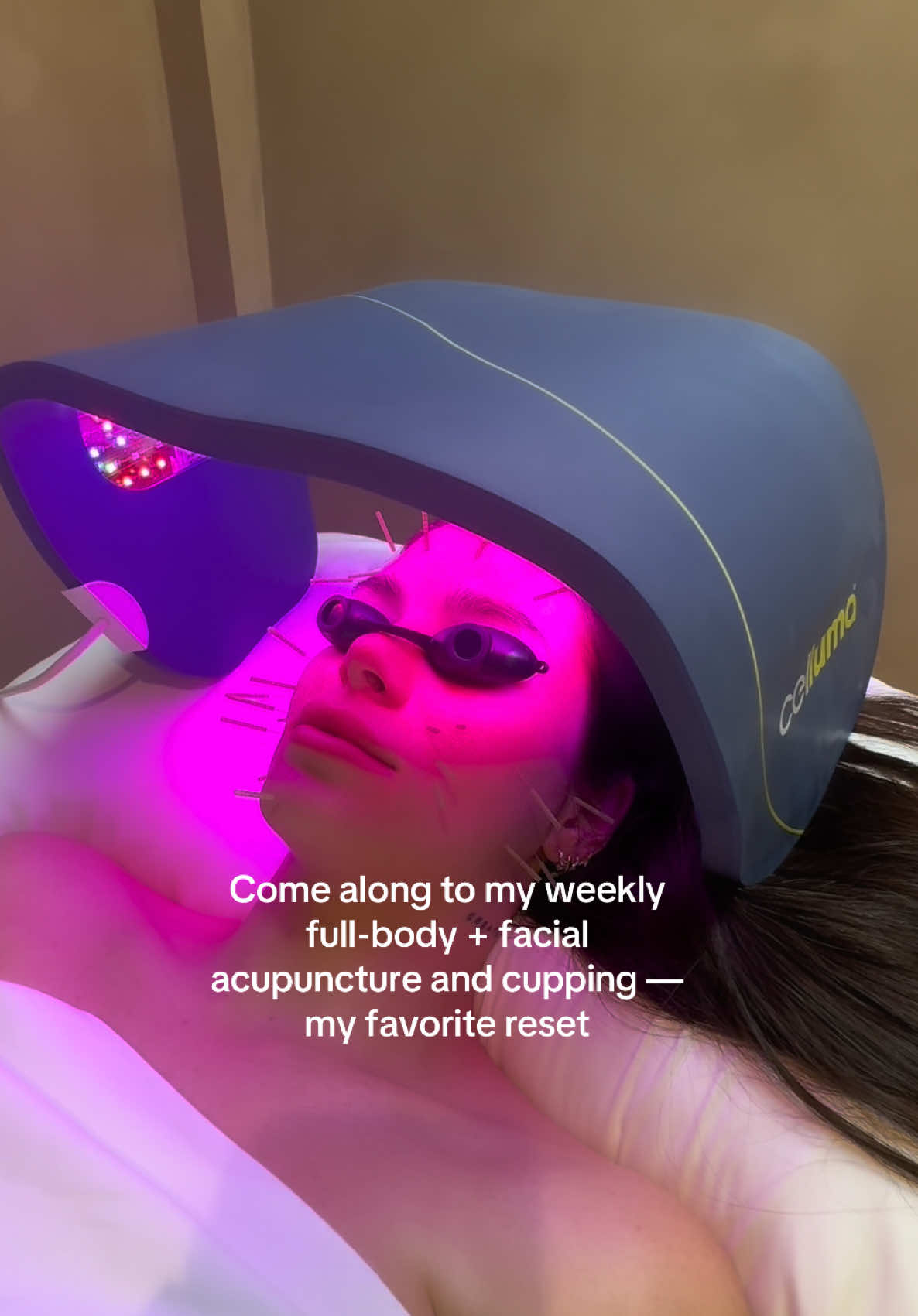 Facial acupuncture is a holistic alternative to Botox it stimulates collagen, smooths lines, and supports your overall well being. Paired with cupping and full body acupuncture, it balances the body inside and out. Chinese medicine has been practiced for over 2,000 years, and licensed doctors complete up to 8 years of training, just like MDs.  ✨ Facial acupuncture → collagen + lift ✨ Cupping → circulation + clarity ✨ Full-body acupuncture → balance + stress relief ✨ Botox → fast wrinkle-smoothing (3–4 months)  #FacialAcupuncture #HolisticBeauty #NaturalBotoxAlternative #MEskinstudio #myesthetician