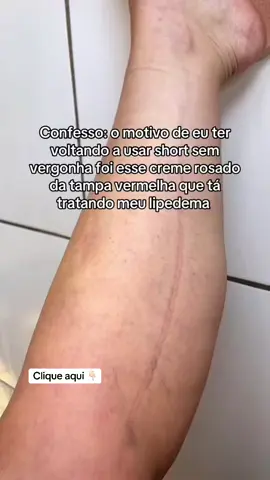 Minhas pernas são outras depois desse tratamento com o creme POPO! #tiktokshopchegou #cremerosa #popozuda #lipedema 