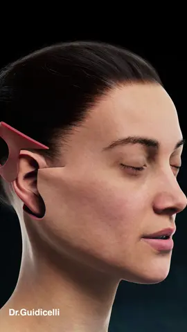 Deep plane facelift, le lifting profond du visage pour un résultat naturel et durable #deepplanefacelift #chirurgieesthetique #plasticsurgeon #plasticsurgery 