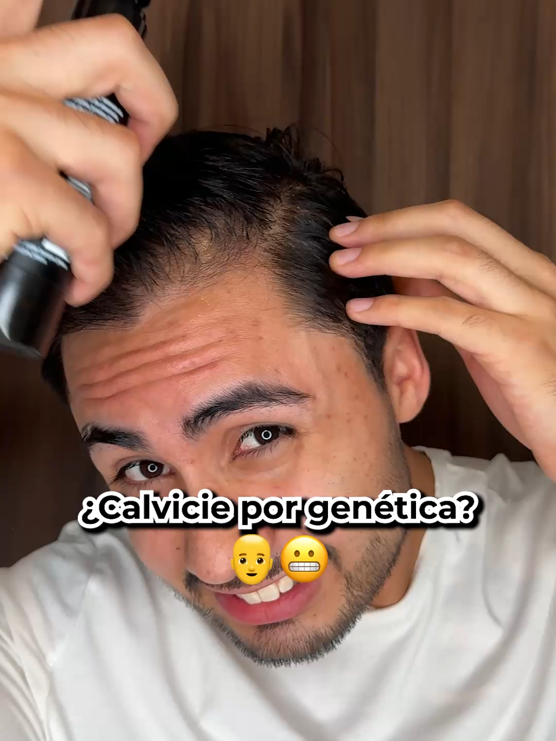Adiós calvicie. Resultados garantizados o tu dinero de vuelta.