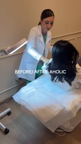 We have to take 60 MILLION short clips, long clips, pictures, videos of side view, top view #lavidaclinic #trendyvideo #beforeandafter #botox #aesthetic 