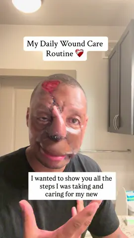 Hey everyone! I wanted to invite you all into what the daily aftercare looks like for me following this last procedure. Some things will change as the days go by and things heal but for now this is what I will be doing in the early stages. As always I look forward to your feedback.  I love you and God bless you family 🙏🏾❤️💪🏾 #ranriseup #riseupran #riseup #stillundefeated #carryyourcross       