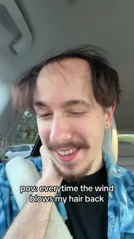 balding is something fierce! don’t worry i’m medicated 