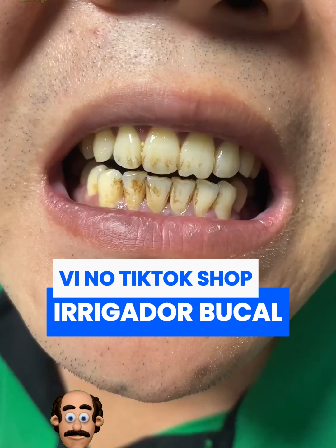 Seus dentes não tão amarelados, tão pedindo socorro 🦷💀 Esse treco vibra mais que celular e arranca até o tártaro da vergonha. 💸 Economize no dentista → invista em prevenção! ✔ Limpeza profunda em casa. ✔ Substitui limpezas caras. ✔ Fácil, rápido e seguro. ✔ Dentes mais limpos em menos de 1 minuto. ⚡ Oferta exclusiva no carrinho → garanta hoje e nunca mais gaste à toa no consultório. #RemovedorDeTartaro #DentesBrancos #SaudeBucal #TikTokShopping #Higiene #SorrisoPerfeito #irrigadorbucal #sorriso #dente  #boca #motivacao #tiktokshop