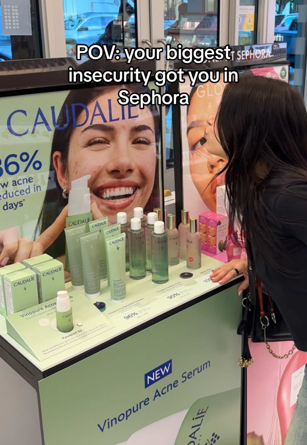 Reminder that your insecurity is your power and that you are beautiful with or without acne❤️