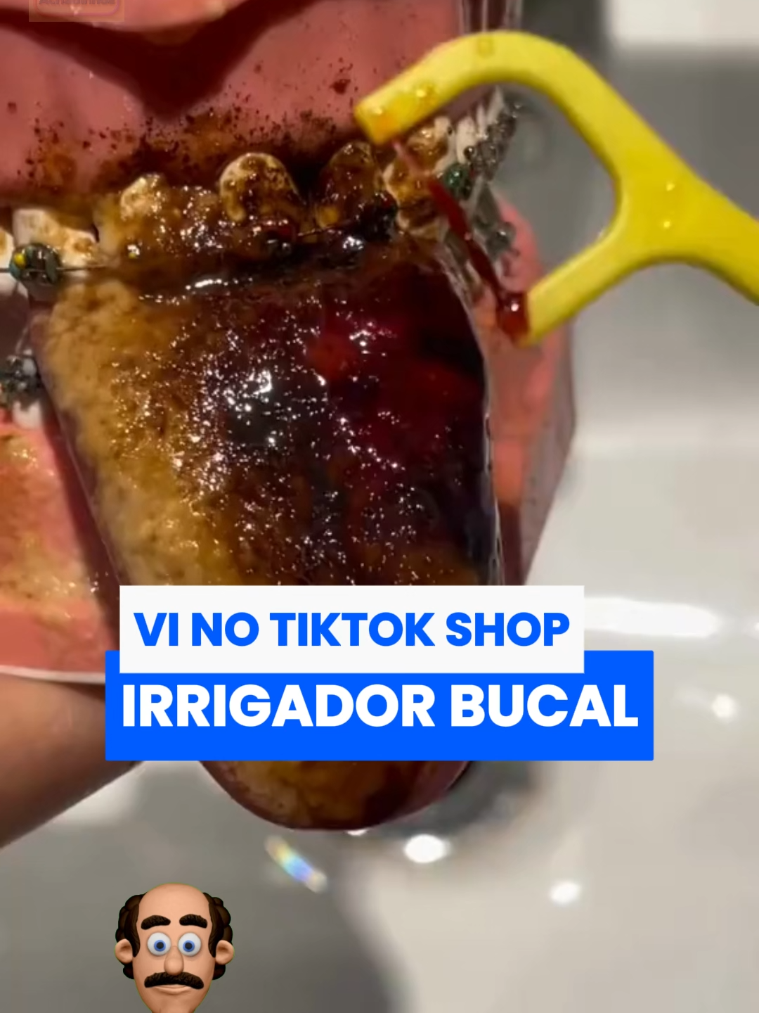 Seu bafo não é café… é esgoto 😬🚰 Esse irrigador vai salvar sua boca e o nariz dos outros. Tá no carrinho laranja, corre! ✔ Remove manchas e placa acumulada. ✔ Previne cáries e retração gengival. ✔ Recupera o branco do sorriso. ✔ Fácil de usar em casa. 🔥 Promoção por tempo limitado → clique no carrinho e salve seu sorriso ainda hoje. #IrrigadorDental #HigieneBucal #BocaLimpa #TiktokMeFezComprar #OfertasTikTok #PromoRelampago #irrigadorbucal #tiktokshop