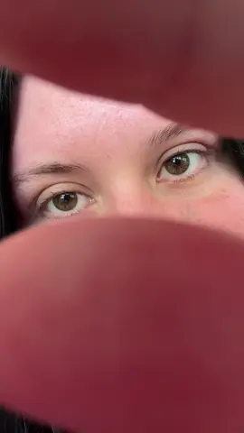 don’t look at my scars 😭