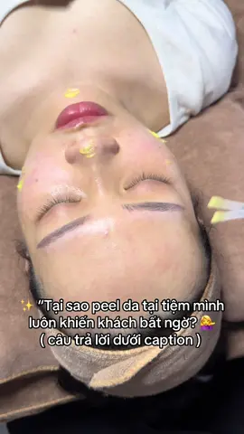 💁‍♀️ Vì mỗi nền da có phản ứng khác nhau, nên thời gian peel không cố định 5 hay 10 phút như quy trình sẵn. 🌿 Khi đến tiệm, mình sẽ trực tiếp quan sát – đánh giá da và điều chỉnh phù hợp, thay vì làm máy móc theo thời gian định sẵn. 💗 Chính sự chăm chút này giúp mỗi buổi peel phát huy tối đa hiệu quả cho từng khách – an toàn và tối ưu hơn.” ✨ #xuhuong #spa #peel #spauytin #dmp 