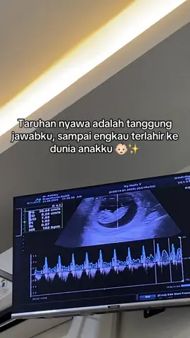 Bismillah masyallah anak ajaibku 🥰👶🏻 sehat sehat di perut bunda ya nak 🫶🏻 #hpljanuari2026 #hamil #trendbumil #bumilhappy #bumilsehat 