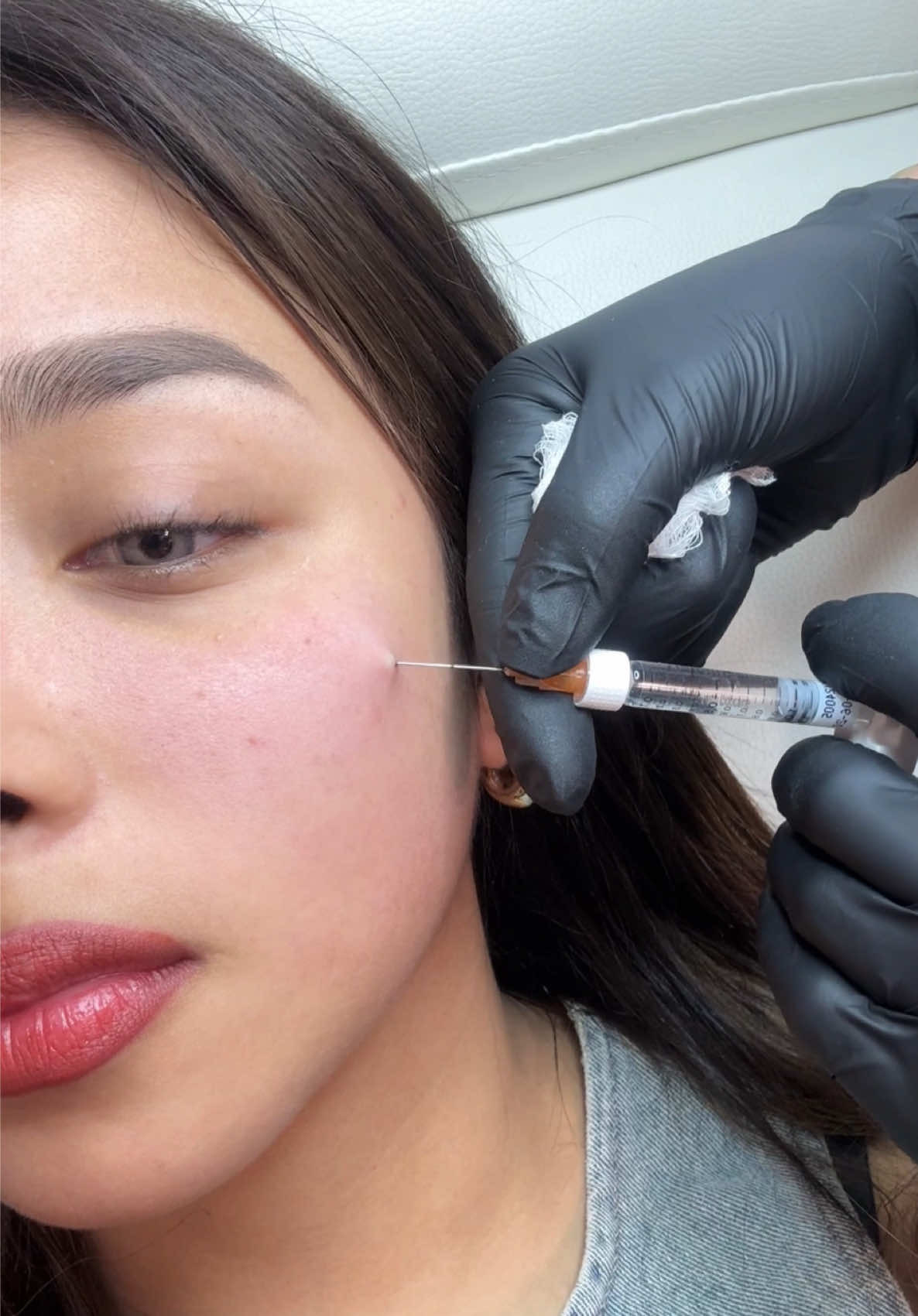 ser bonita no es fácil jaja #cdmx #acidohialuronico #relleno #fillers #ojeras #beauty #fyp 