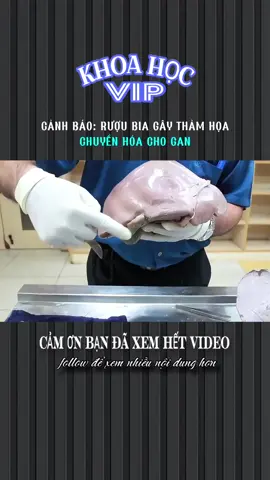 CẢNH BÁO: RƯỢU BIA GÂY THẢM HOẠ CHUYỂN HÓA CHO GAN #xh #xhtiktok #khampha #LearnOnTikTok #khoahocvip 
