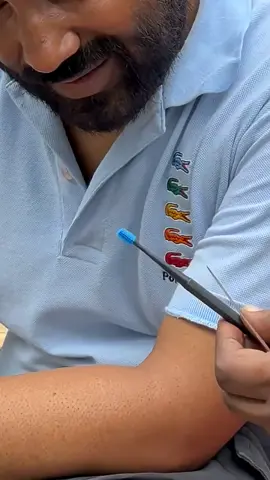 This Indian Guy Got a Full VIP Ear Cleaning Experience for Just $0.10 and You Won’t Believe How Professional It Looks 😂💰 #india #ear #asmr #clening 