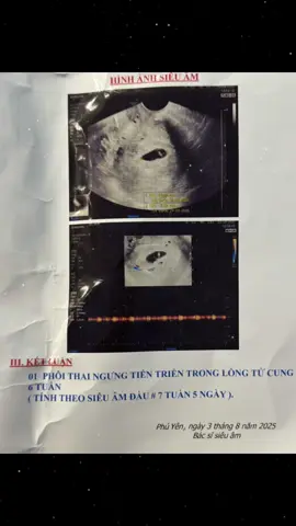 Tạm biệt thiên thần nhỏ 7w của mẹ , em bé đầu tiên của mẹ , mẹ không biết Thiên đình có chuyện gì mà gọi em về sớm thế … :(( em chỉ mới ở với mẹ vỏn vẹn 7w, mẹ vẫn còn giữ những thói quen khi mẹ ở với em . Mẹ  luôn tự trách phải chăng mẹ đi đứng quá nhiều làm em không bên cạnh mẹ nữa, hay mẹ vô tâm … em bé ơii , mau về với mẹ nhé.. mẹ nhơ em lắm #hiemmuon #mangthai #baby #xuhuong #mebau #trending #foryou 