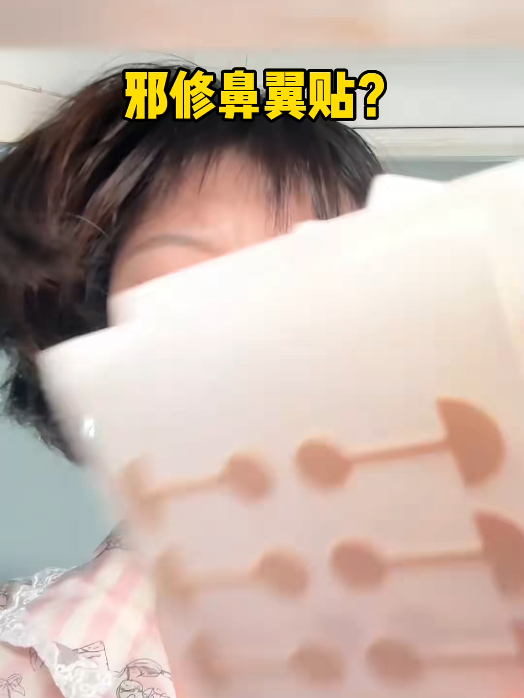 77.老天爷跟了我二十多年的蒜头鼻有救了#变美逆袭 #亲测分享 #鼻翼大 #鼻翼贴