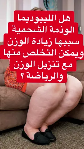 ليبوديما الوذمة الشحمية✨ . . #دوالي #ليبوديما #اكسبلور #القدم_السكري #الدوالي #الوذمة_الشحمية #الوذمة_اللمفاوية #الوذمة_الوعائية #fyp  #الشعب_الصيني_ماله_حل😂😂 