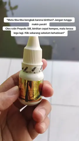 Propolis SM bantu kalazion mengecil setiap hari #PropolisSM #Kalazion #Bintitan #MataNyaman #HerbalAlam