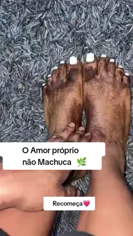 #pelesaudavel #Mancha #manchas #estrias #foryoupage❤️❤️ Partilha!