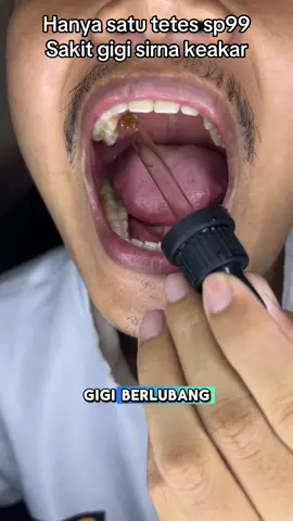 Ramztag#permasalahangigi #obatsakitgigi #sakitgigi 