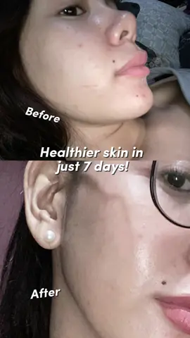 try this out now, TEASHELL triple whitening moisturizing serum 💆🏼‍♀️ #teashell #teashellxjmcyserum #teashelltriplewhitening #moisturizing #serum 