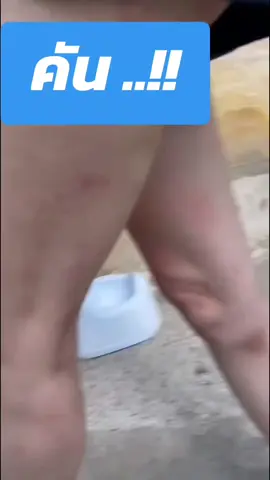 Sanderma Cream เป็นผลิตภัณฑ์ครีมทาภายนอกที่ใช้สำหรับดูแลปัญหาผิวหนังต่างๆ  ช่วยบรรเทาอาการคัน ผิวแห้ง ผิวลอกเป็นขุย รวมถึงอาการที่เกิดจากโรคผิวหนัง ผื่นคัน แพ้เหงื่อ กลาก และเกลื้อน #ของมันต้องแชร์ 