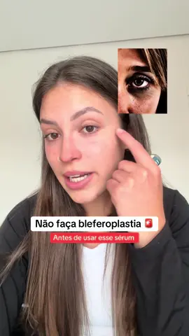 Depois me contem o que acharam 🩵  #olheiras #linhasdeexpressão #flacidez #rugasdeexpressao #linhasfinas 