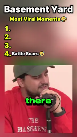 My legs are mostly scarred 😂🤣#foryou #viral #fyp #basementyardpodcast #basementyard 