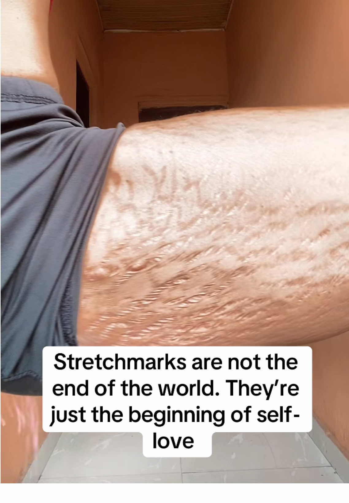 Who else is done hiding their stretchmarks?#tiktoknigeria🇳🇬 #foryourpages #fyp #thatstrechmarkgirl #debrah_richard 