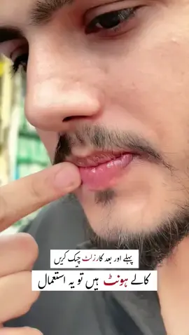 Wiki Special Lip Balm  What's App  03074076030