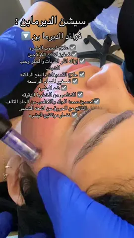 فوائد سيشن الديرما بن ☑️❤️ #viral #dermapen #tik_tok #trendingvideo #viral_video 