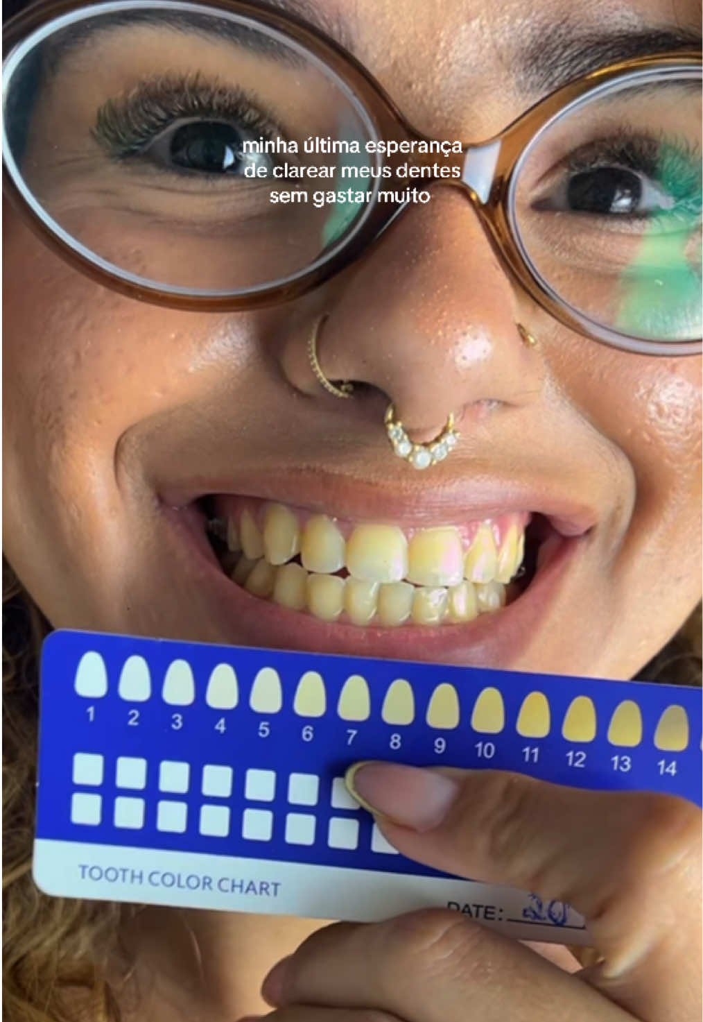 DIA 1 usando clareamento dental caseiro. Vou postar nos próximos dias também 