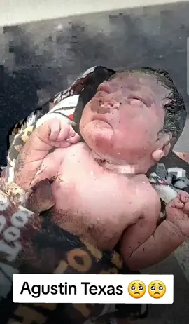 Esta tarde una bebé recién nacida fue encontrada por una mujer en un basurero de unos apartamentos en North Lamar Blvd. en Austin Texas. 😱🥺 La bebé fue trasladada al hospital y se encuentra a salvo. Servicios de emergencia acudieron a la zona tras recibir una llamada alrededor de la 1:37 p. m. La investigación está activa. 😱😱 #austintx #northlamar #bebe #abandonado