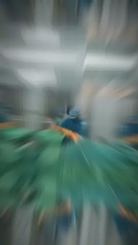 Đóng đinh nội tủy là một trong những phương pháp kết hợp xương hiệu quả, thường được áp dụng cho các trường hợp gãy xương chi dưới (xương đùi, xương chày) có chỉ định phẫu thuật.  Với kỹ thuật đóng đinh kín không mở ổ gãy, phẫu thuật viên chỉ cần một số đường rạch da nhỏ để đóng đinh vào lòng tủy và bắt vít chốt cố định, giúp hạn chế xâm lấn, bảo tồn phần mềm và màng xương. Nhờ đó, bệnh nhân ít đau, mất máu tối thiểu, giảm nguy cơ nhiễm trùng, sẹo mổ nhỏ và thẩm mỹ hơn, đồng thời giảm thời gian liền xương và phục hồi chức năng được rút ngắn. #gayxuong #chanthuongchinhhinh #coxuongkhop #orthopedics #trending 