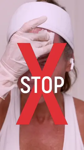 Fan brushes and droppers might look fancy, but they’re risky. A viral case just showed how a dropper caused a serious acid burn. Gauze gives you control, consistency, and safety every time. Full Demo https://www.naturalkaos.com/diy-30-tca-peel-at-home-full-demo-recovery/ In my new 30% TCA Peel series, I document the entire process so you can see what a real peel looks like and how I apply it safely. • Part 1 is live on my Spa and Tell YouTube channel. • The full demo is only available on my Natural Kaos blog. Save this as a reference and share it with anyone considering a peel. #chemicalpeel #tcarecovery #skincareroutine