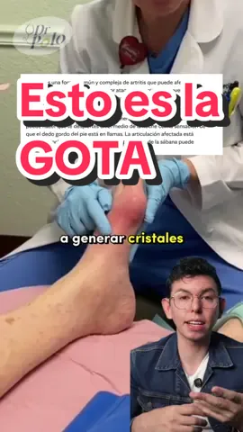 Si te gusta la cerveza y la carne roja ESTE VIDEO TE INTERESA! 🍺🥩(Revisa tus niveles de ácido urico), más en YT #medicina #salud #SabiasQue #doctor #AprendeEnTikTok 