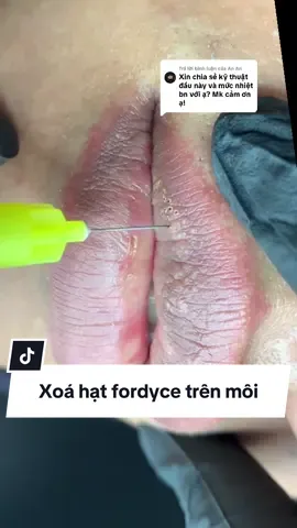 Trả lời @An An Xoá hạt fordyce trên môi  📣📣📣 #plasma #hutmaumoi #plasmamoi #xoanhanmoiplasma #khuthammoidepbacninh_bacgiang 