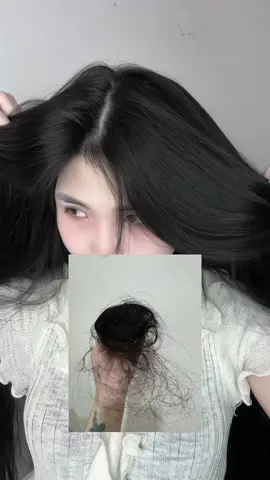 Chậm tý nữa thì hói #haircare #hiennhonhanne #tocdep #onehair #serumduongnangtoc 