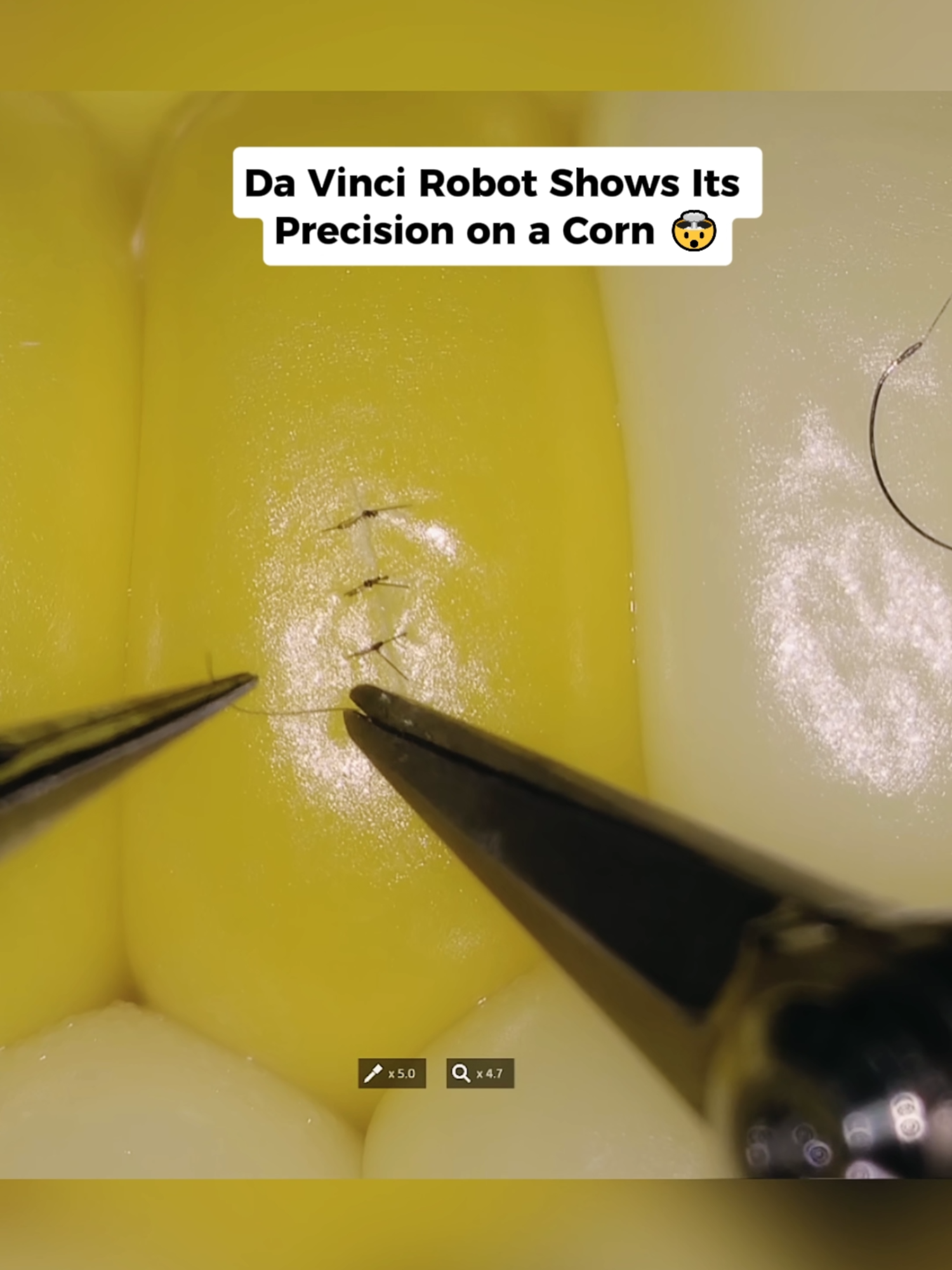The Da Vinci Surgical System demonstrates astonishing precision by performing surgery on a corn kernel 🌽. Using robotic arms guided by physics principles of motion, force, and torque, the system carefully slices through the kernel’s skin and then stitches it back together with micro-accuracy. This process showcases concepts of mechanics, kinematics, and robotics engineering, where every movement depends on balance, velocity, and controlled angular momentum. Watching the robot operate on something as delicate as a single corn kernel highlights how physics and technology combine to push the limits of modern surgery and medical innovation. #physics #techtok #surgery #robot #fyp