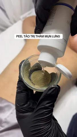 Thâm mụn lưng peel gì 👉#mayspa #peel_trị_thâm_mụn_lưng #tảo_2a #trị_mụn_chuẩn_y_khoa #spa_thanh_xuân_HN 