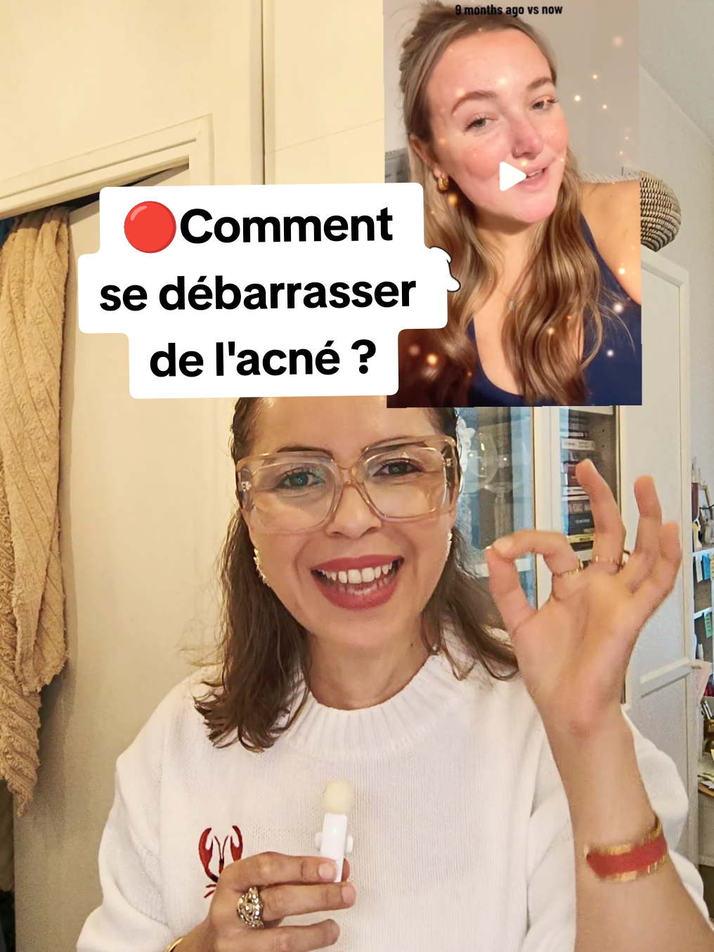 J'ai trouvé le produit naturel de fou pour se débarrasser de l'acné 🔴 #acné #tiktokshop #viralproduct #tiktokmademebuyit #peaunette 