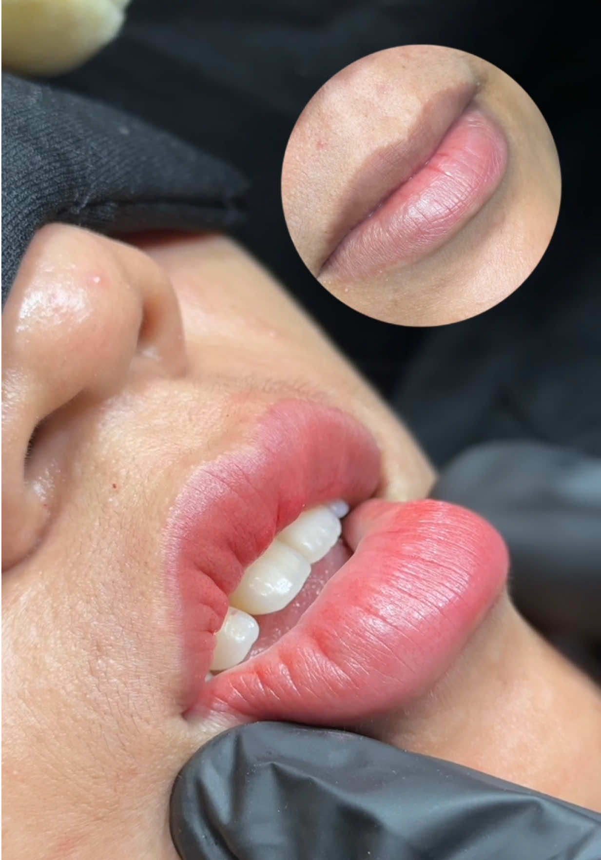 khử thâm môi 💋 #cuchi #khuthammoi #khuthammoitunhien #xuhuong #viral 