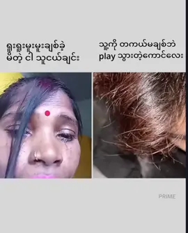 မတန်မရာသွားမှန်းတာကို NEW ACC@⚡𝐏𝐑𝐈𝐌𝐄 ⚡  #foryou #myanmartiktoks #alinght_motion_edit_ #PRIME 