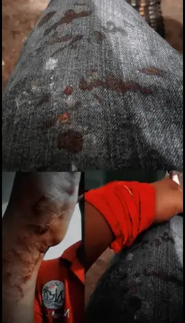 so sad life mero🥺🥺