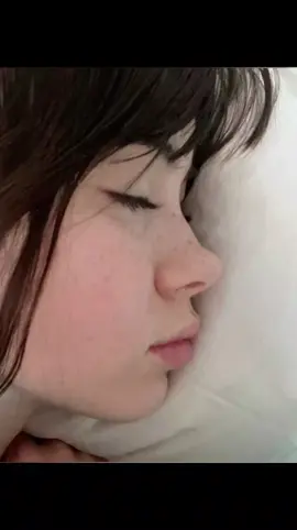 #xybca #fyp #viral #nose #greek 