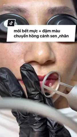 1 buổi co2 e sẽ cứu lại cái môi liền cho mấy chị em mình trẻ ra mấy tuổi #spaceleryquan12 #co2 #moi #co2laser #hutmucmoi 