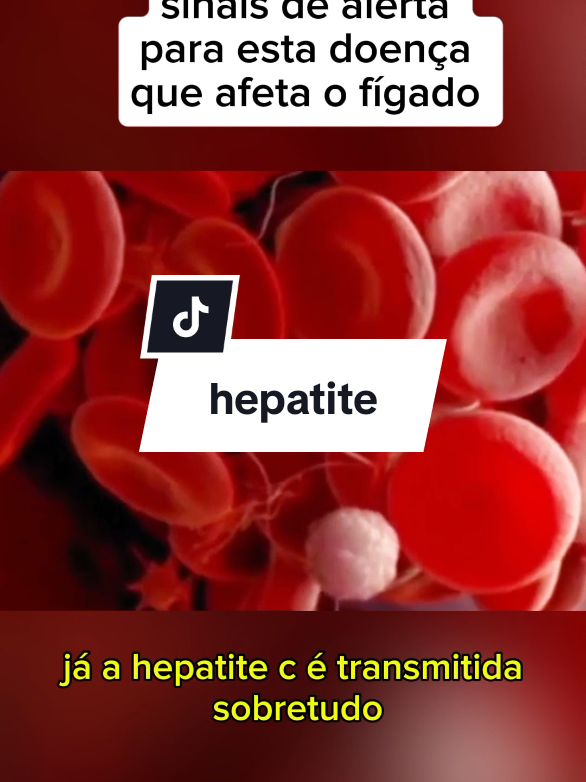 doenca que afeta o fígado #saude #hepatite #figado #sintomas 