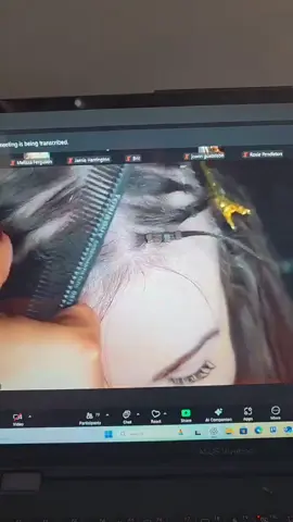 If I ever told you there's nothing you can do about the thinning on the top of your head i was WRONG. Advanced Mesh and meshless integration is changing the game and I am looking for some models to showcase transformative results. Comment mesh or text me keyword mesh to +1 506-804-2725