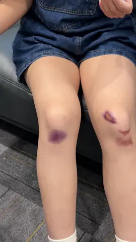 Realistic Scar Tattoo Sticker - Prank Halloween 🎃 - Limited Time Discount#tattoo #tattoos #tattooartist #fyp 