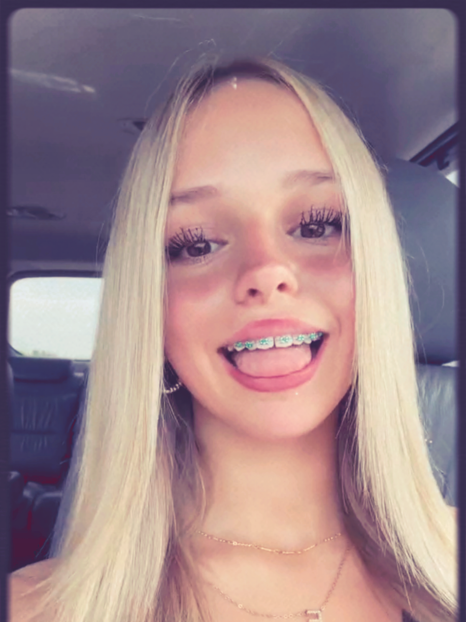 @addisonsicard 🔥🔥 #fyp #baddid #braces #bracestok #bop 